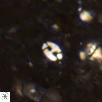 Lanternithus duocavus VR 00075