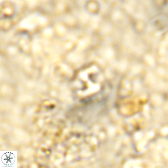 Lanternithus duocavus VR 00085