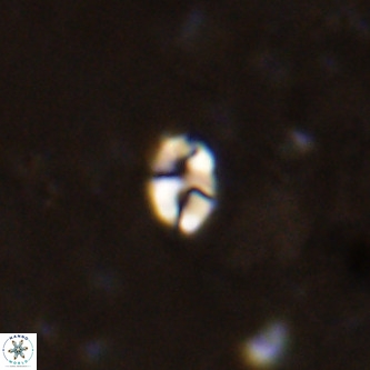 Lanternithus duocavus VR 00106