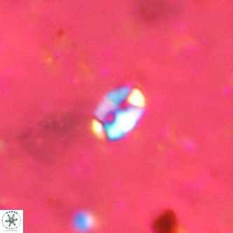 Lanternithus duocavus VR 00108