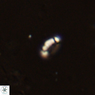 Lanternithus duocavus VR 00316