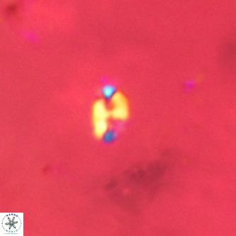 Lanternithus duocavus VR 00318