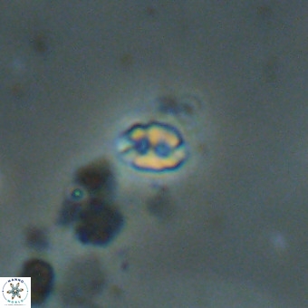 Lanternithus duocavus VR 00332