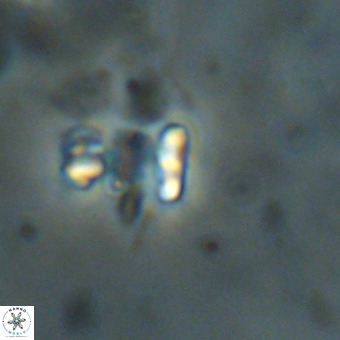 Lanternithus duocavus VR 00337