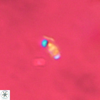 Lanternithus duocavus VR 00359