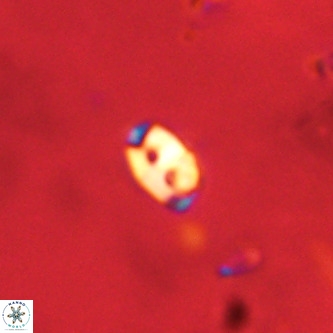 Lanternithus duocavus VR 01651