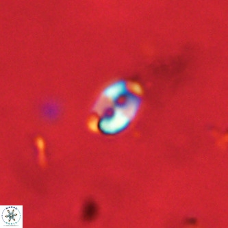 Lanternithus duocavus VR 01652