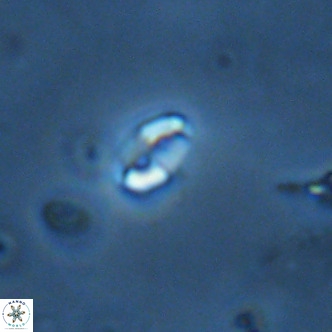 Lanternithus duocavus VR 01657