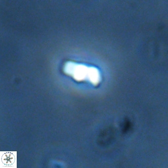 Lanternithus duocavus VR 01660