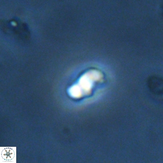Lanternithus duocavus VR 01662
