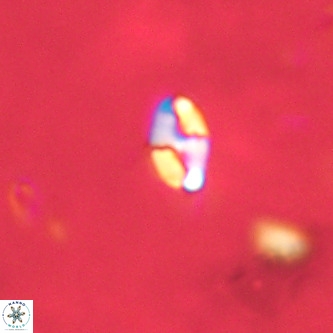 Lanternithus duocavus VR 01665