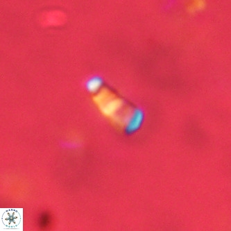 Lanternithus duocavus VR 01669