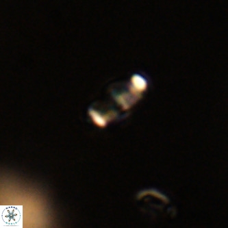 Lanternithus duocavus VR 01018