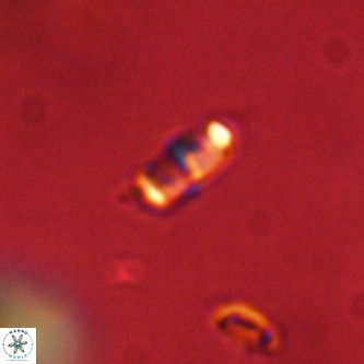 Lanternithus duocavus VR 01019