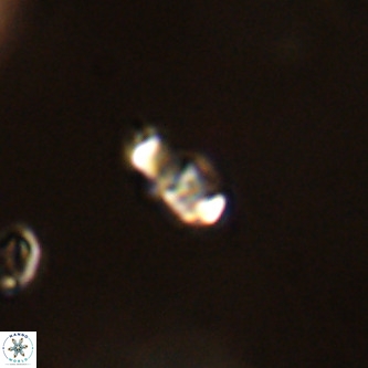 Lanternithus duocavus VR 01025
