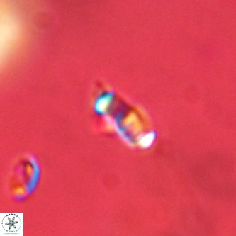 Lanternithus duocavus VR 01027