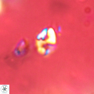 Lanternithus duocavus VR 01031