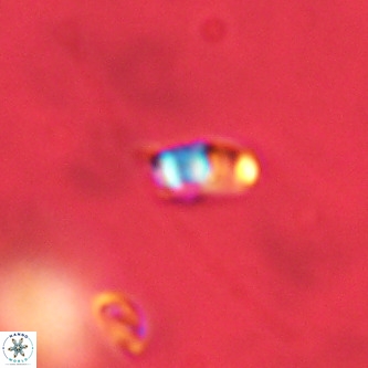 Lanternithus duocavus VR 01035