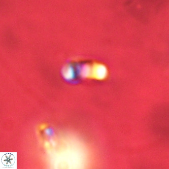 Lanternithus duocavus VR 01046