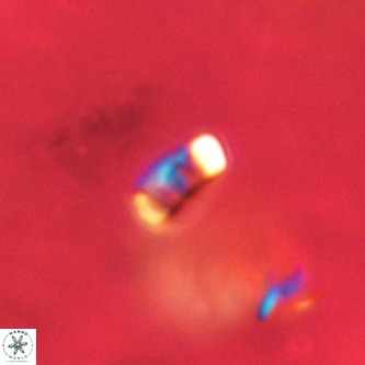 Lanternithus duocavus VR 01074