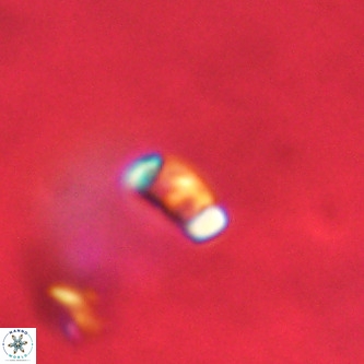 Lanternithus duocavus VR 01075