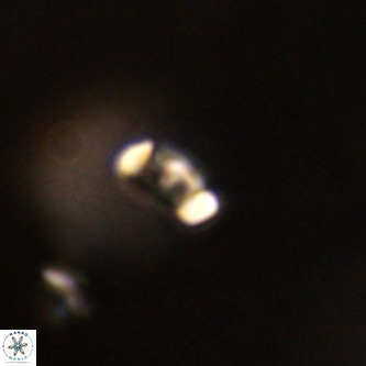 Lanternithus duocavus VR 01076