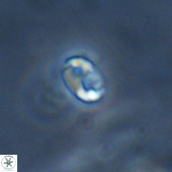 Lanternithus duocavus VR 01087