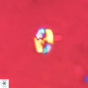 Lanternithus duocavus VR 01096