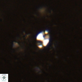 Lanternithus jawzii VR 00164