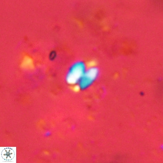 Lanternithus jawzii VR 00169