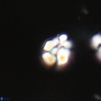 Lanternithus minutus VR 33450