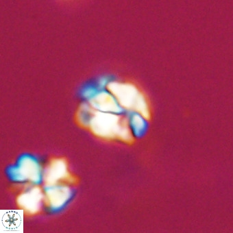 Lanternithus minutus VR 33463