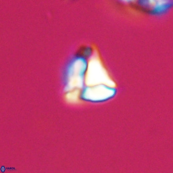 Lanternithus minutus VR 33433