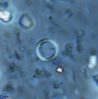 Leptolamprocyclus eurystomus 42901