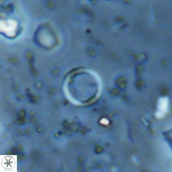 Leptolamprocyclus eurystomus 42901