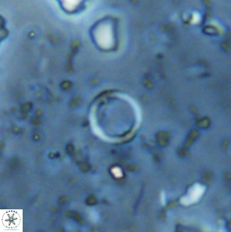 Leptolamprocyclus eurystomus 42902