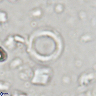 Leptolamprocyclus eurystomus 43617