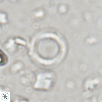 Leptolamprocyclus eurystomus 43617