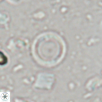 Leptolamprocyclus eurystomus 43618