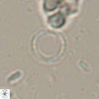Leptolamprocyclus eurystomus 53835