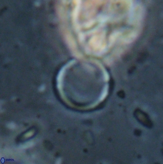 Leptolamprocyclus eurystomus 53836