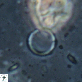 Leptolamprocyclus eurystomus 53836