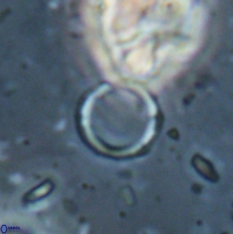 Leptolamprocyclus eurystomus 53837