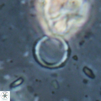 Leptolamprocyclus eurystomus 53837