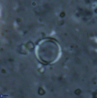 Leptolamprocyclus eurystomus 53831