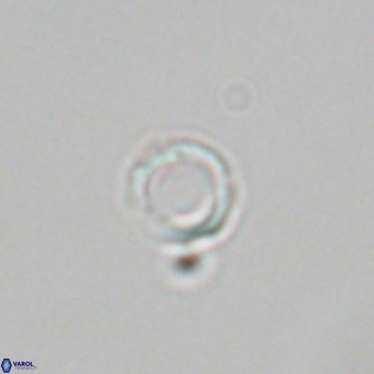 Leptolamprocyclus eurystomus 70664
