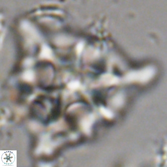 Lithostromation perdurum VR 06777