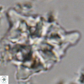 Lithostromation perdurum VR 06778