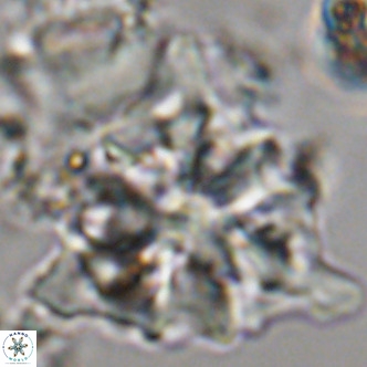 Lithostromation perdurum VR 06781