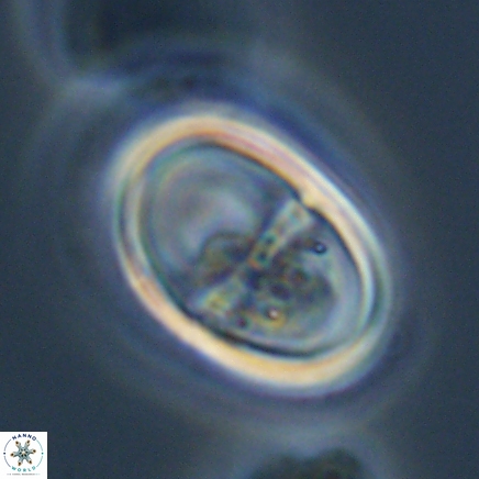 Lophodolithus nascens 24313 1